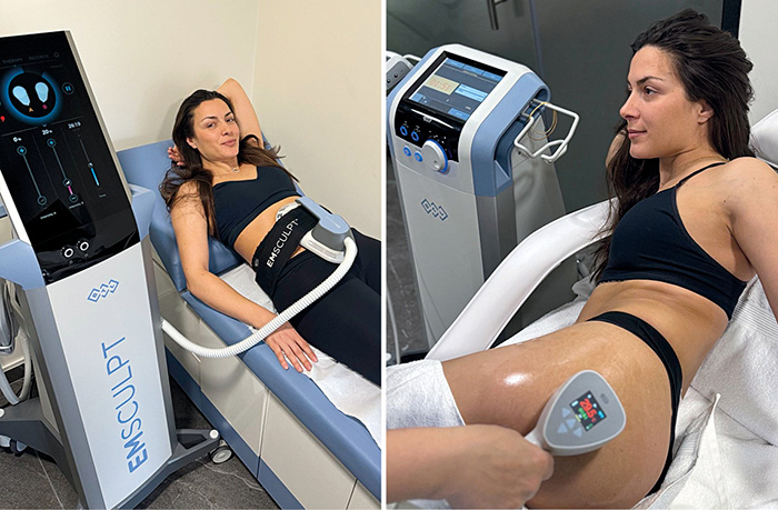 Wholly AGain emsculpt.jpg 